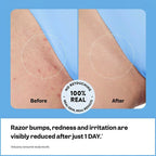 Smoothing Solution Ingrown Hair